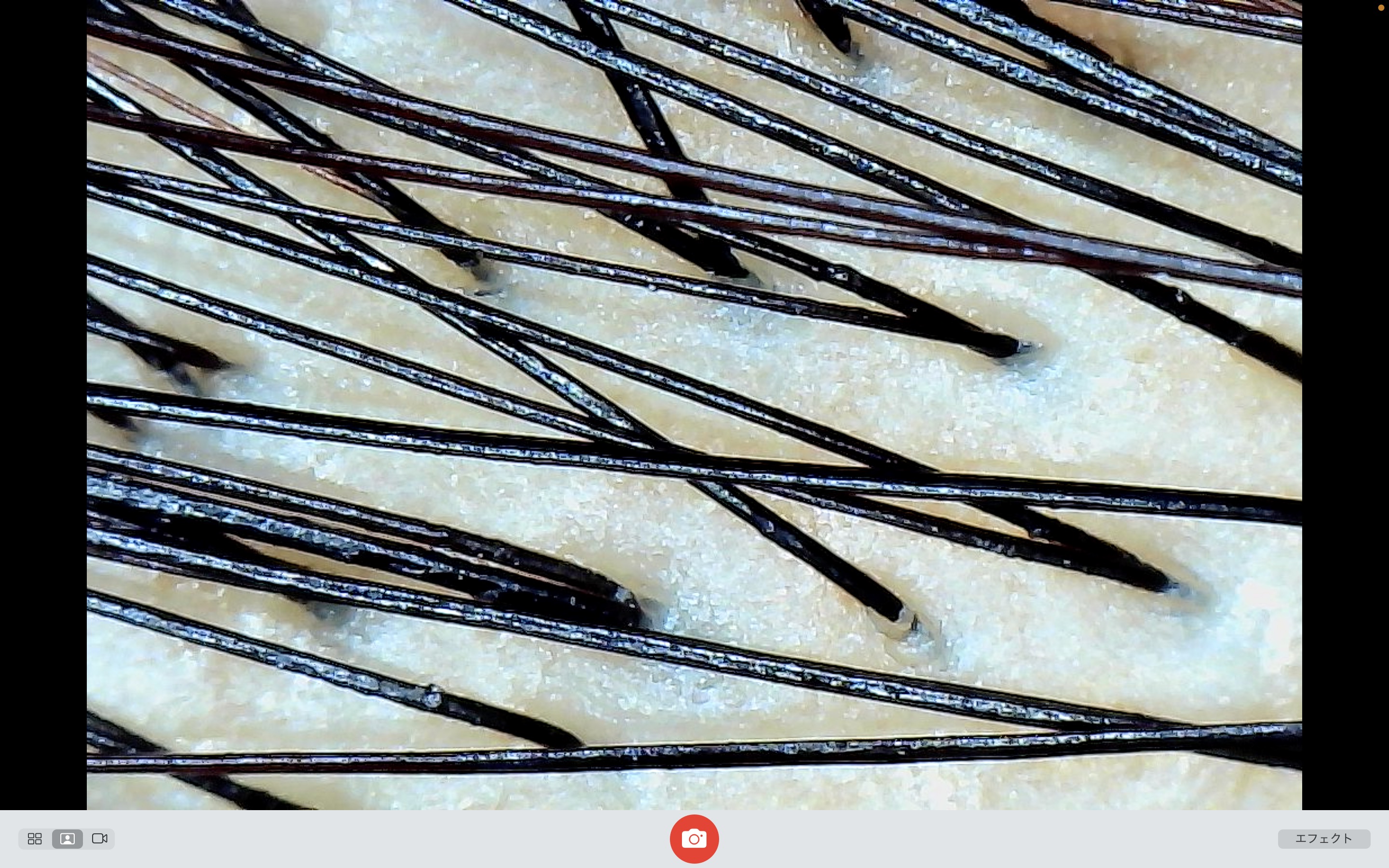 マイクロスコープ検査の様子